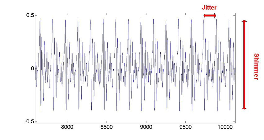 jitter vs shimmer